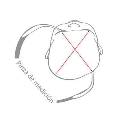 Medir la deformación de la cabeza del bebé