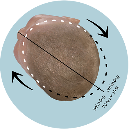 Babyhoofd correctie positie plagiocefalie