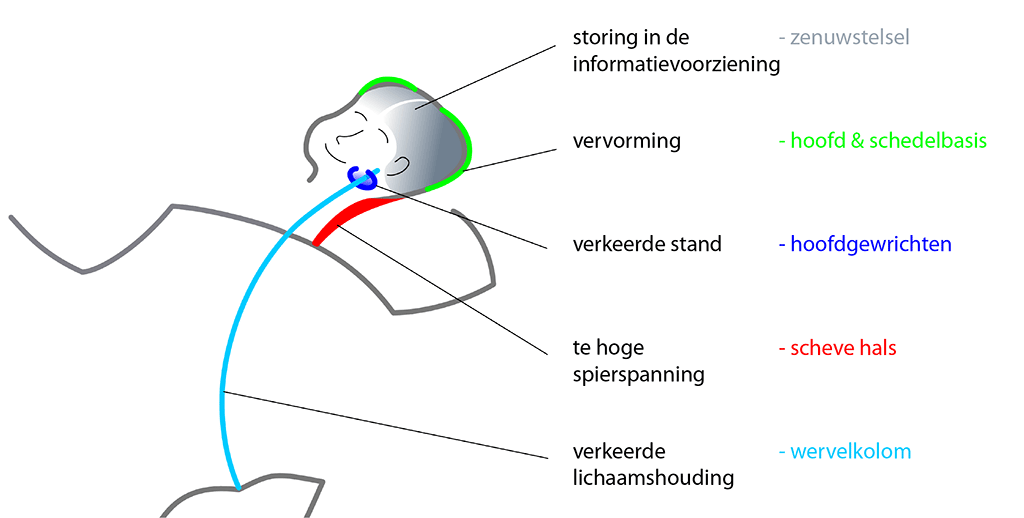 Symptoom complex van posturale asymmetrie in fancy