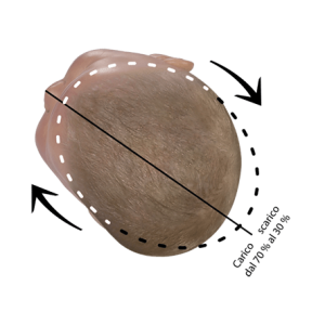 Posizione corretta della testa del bambino plagiocefalia