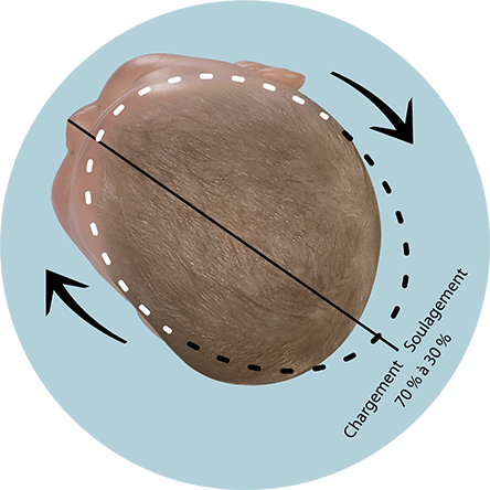 Position de correction tête du bébé plagiocéphalie
