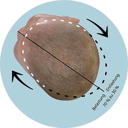 Babykopf korrekturposition plagiocephalus