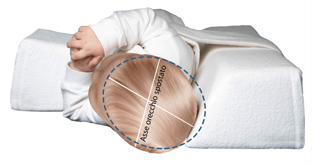 Immagine del prodotto Vista frontale Stecca laterale VARILAG Cuscino di posizionamento