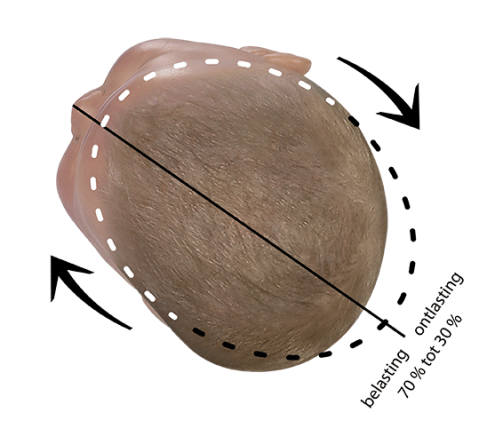 Babykopf korrekturposition plagiocephalus