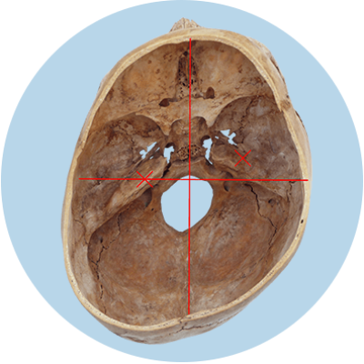 schaedelbasis von oben