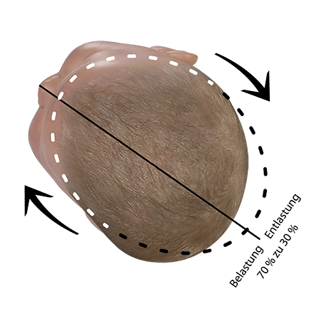 Babykopf korrekturposition plagiocephalus