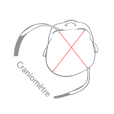 Mesurer la déformation de la tête du bébé