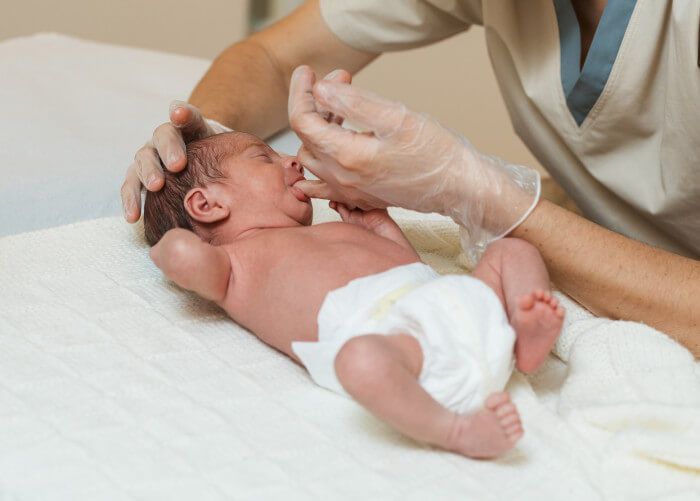 Beratungsthema: Schwierigkeiten beim Stillen bei der U3 Untersuchung