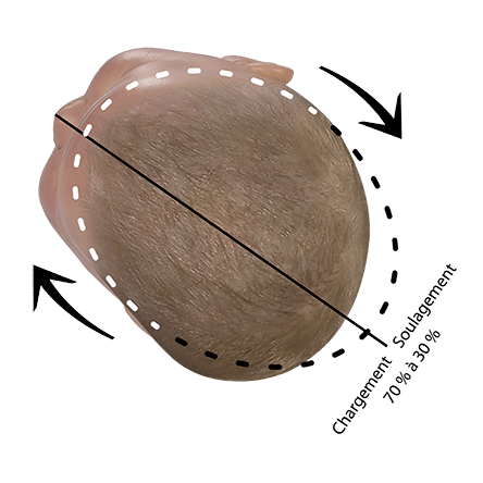 Position de correction tête du bébé plagiocéphalie