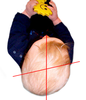 Baby Kissen Orthopädisches Kopf Gegen Kopfverformung Matratze Lagerungskissen DE 