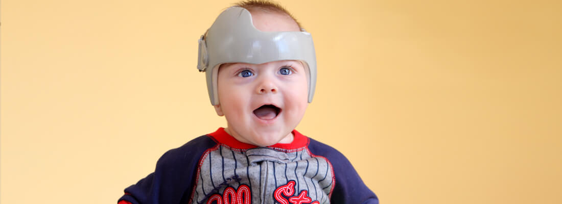 Terapia con casco para bebés