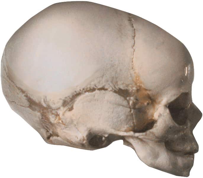 Cranio di un neonato