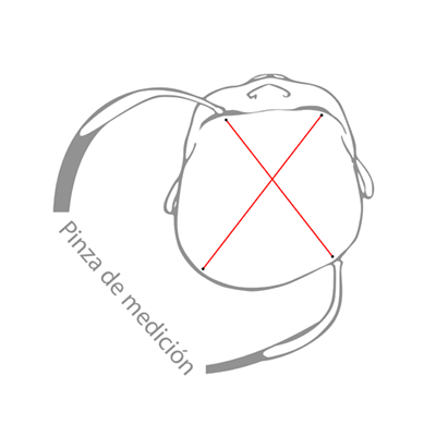 Medir la deformación de la cabeza del bebé