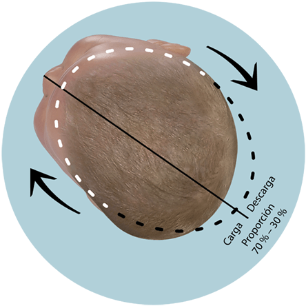 Posición de corrección de la cabeza del bebé plagiocefalia