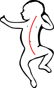 Vermessen der baby kopfverformung