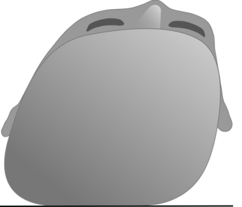 Schematische Darstellung eines Plagiocephalus