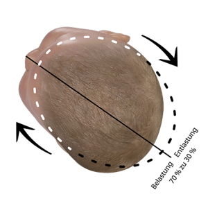 Babykopf korrekturposition plagiocephalus