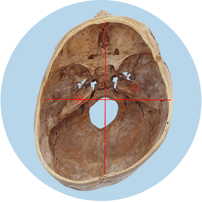 schaedelbasis von oben